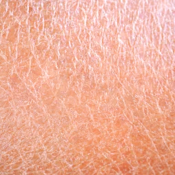 Skin roughness