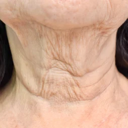 photo of a old woman's neck