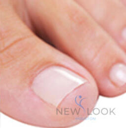 Toe nails