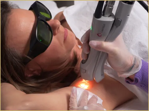 Woman having underarm Laser hair removal epilation.
