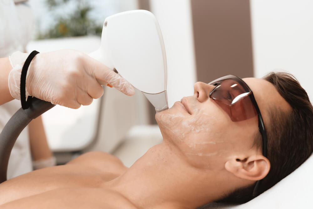 man doing laser hair removal treatment in texas